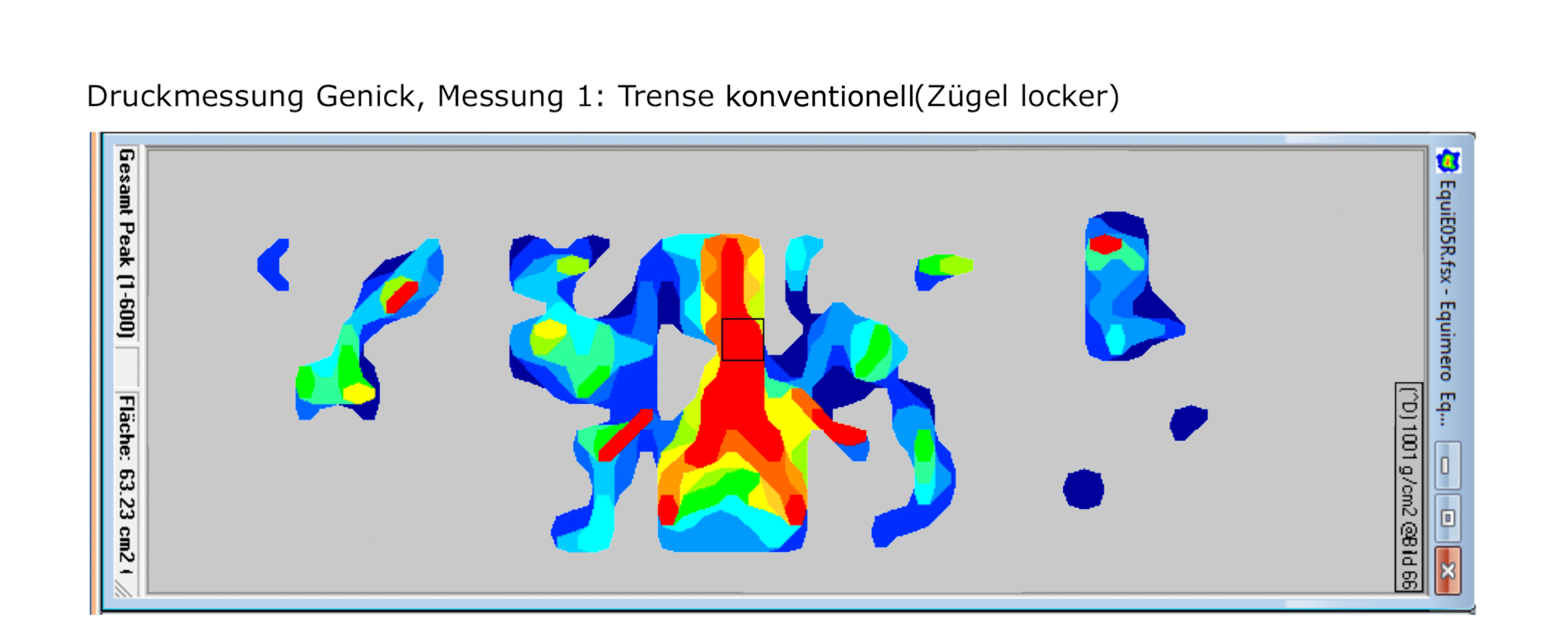 Druckmessung_1